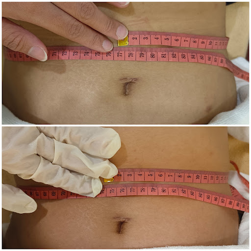 Lueur Laser & Skin