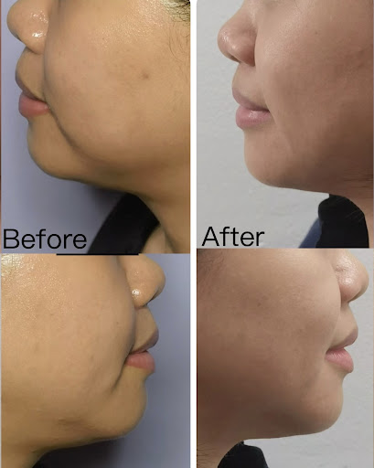 Easy Beauty & Slimming