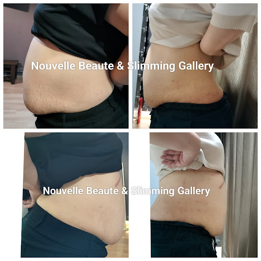 Nouvelle Beaute & Slimming Gallery