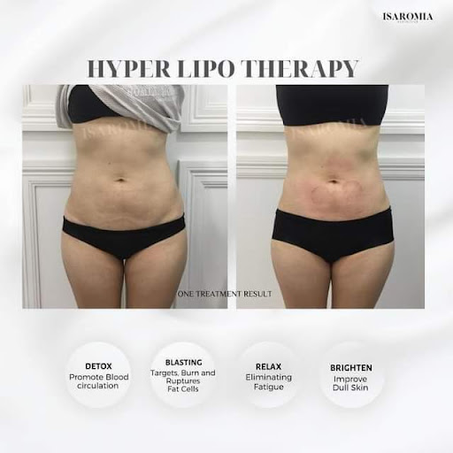 Isaromia Aesthetics JB - Facial, Whitening, Slimming Treatment