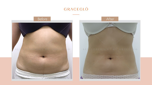 GraceGlo_Aesthetic & Slimming(Southkey)