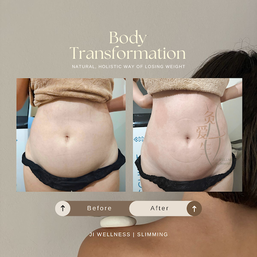 JI WELLNESS | SLIMMING