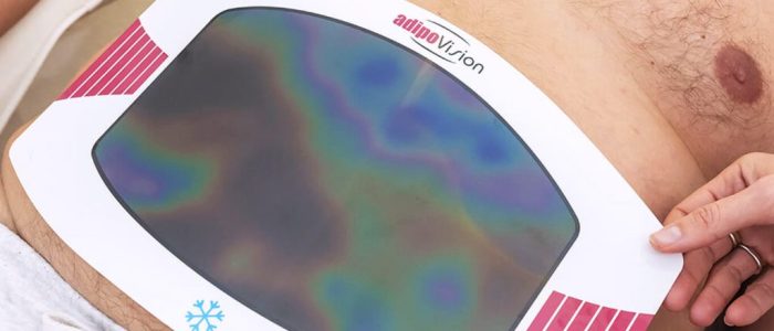 IPS Beauty & Slimming Centre – Rawatan Kecantikan & Penurunan Berat Badan di Malaysia