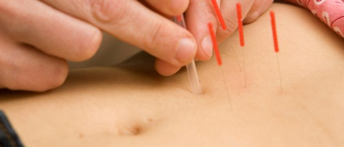 Pusat Akupunktur Slimming – Kurangkan Berat Badan Secara Semula Jadi dengan Terapi Tradisional