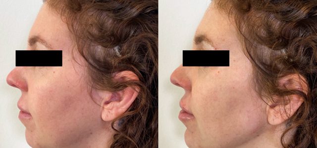 BV Slimming & Beauty Treatment Centre – Klinik Kecantikan & Penurunan Berat Badan Terbaik di Malaysia