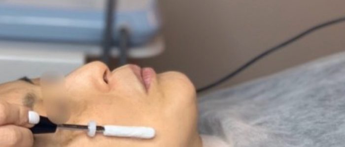Joy Specialist – Rawatan Muka & Penurunan Berat Badan | Pusat Kecantikan Terbaik
