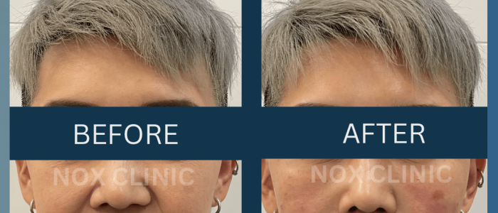 NOX Clinic Pelangi – Rawatan Kulit, Laser, Rambut & Pelangsing | Klinik Kecantikan Terbaik