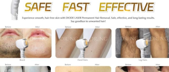 Dr. Ng Skin di Bukit Mertajam – Rawatan Kulit Profesional & Tips Kecantikan