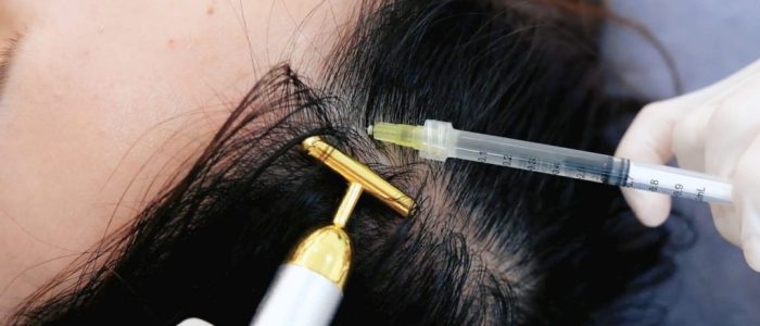 Klinik A.M | Penang Estetik | Pico Laser & HIFU | Rawatan Kebotakan